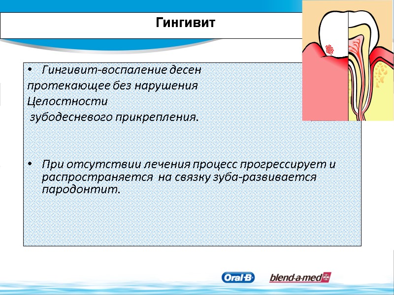 Гингивит Гингивит-воспаление десен  протекающее без нарушения  Целостности  зубодесневого прикрепления.  